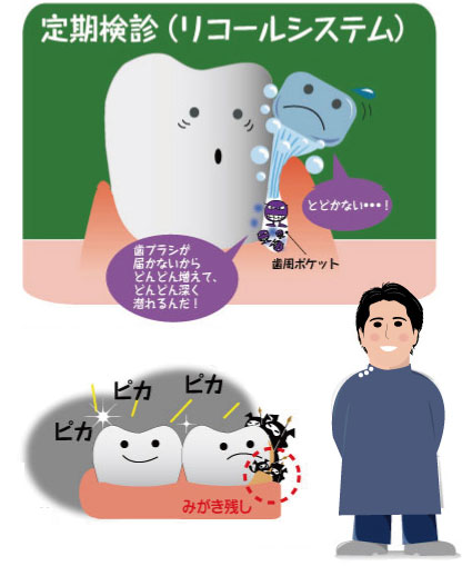 リコールシステム